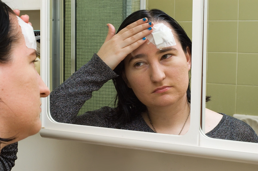 woman looking in a mirror with bandage over scar covers one of the most common car accident injuries